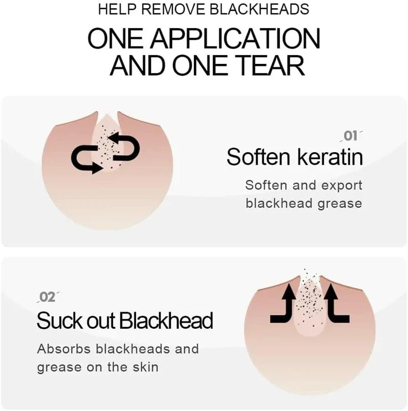 SADOER Bamboo Charcoal Blackhead Removal Mask – Deep Pore Cleansing & Nose Peel-Off Mask